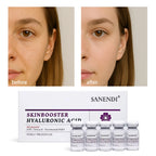 Sanendi SKIN BOOSTER HYALURONIC ACID Facial Skin Problem Solution Moisturizing Hydration Korean Skin Care Protein Solution