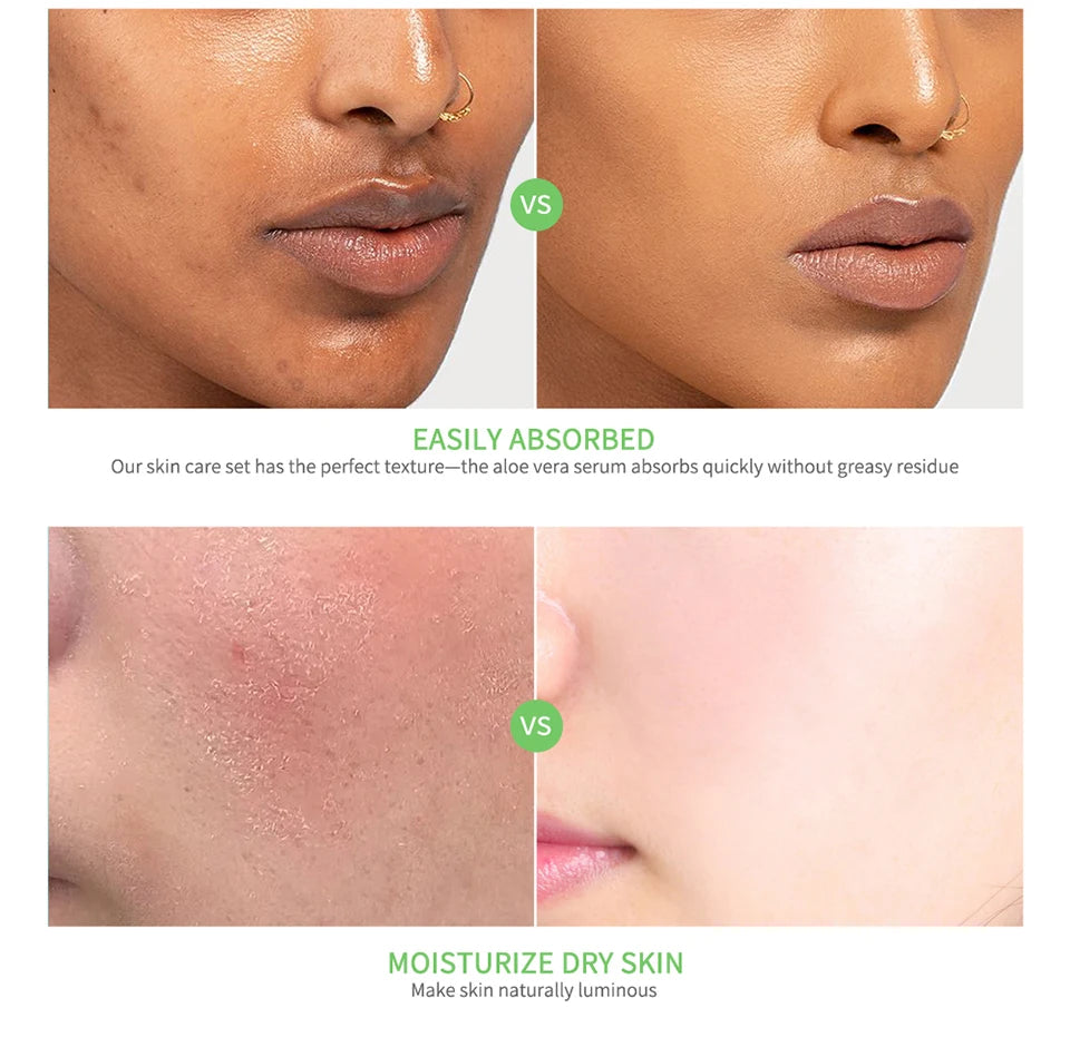 Multi-skin Care Aloe Vera Skin Care Set Deep Moisturizing Deep Nourishment Whitening Brightening Hydrating Smooth Skin