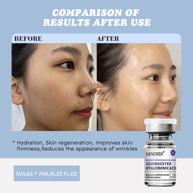 Sanendi SKIN BOOSTER HYALURONIC ACID Facial Skin Problem Solution Moisturizing Hydration Korean Skin Care Protein Solution