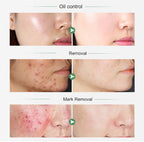 AILKE Organic Turmeric Whitening Skin Care Set, with Vitamin C, Clean Skin, Reduce Acne, Hydrating and Firming for Women