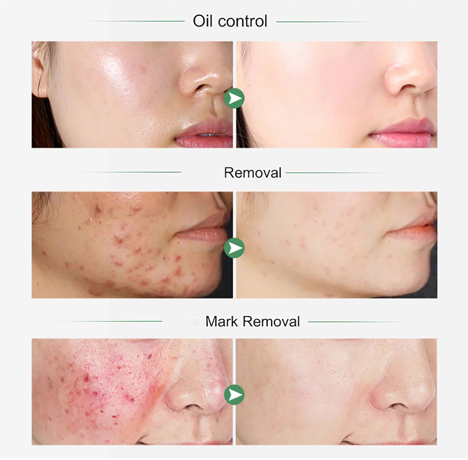 AILKE Organic Turmeric Whitening Skin Care Set, with Vitamin C, Clean Skin, Reduce Acne, Hydrating and Firming for Women